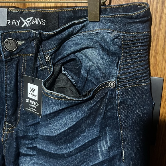 X-RAY - Picture 3 of 6